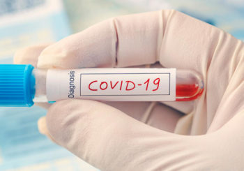 Test Sierologici per ricerca anticorpi anti-Covid 19