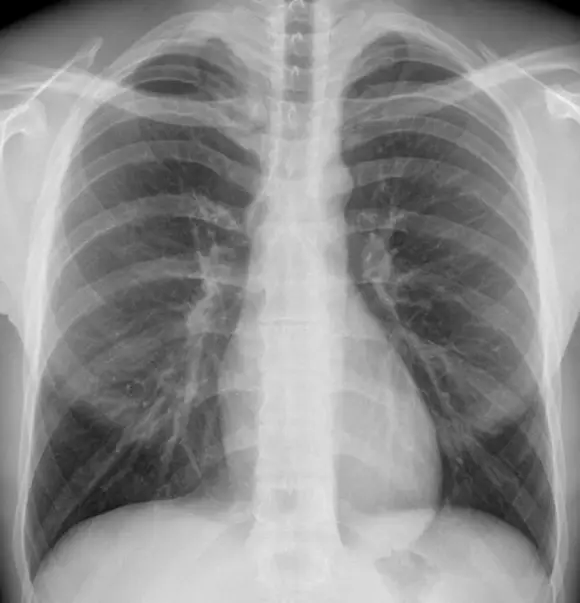 Tac e Risonanza Magnetica con e senza mezzo di contrasto per via endovenosa